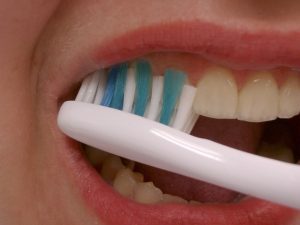 Cedar City Teeth Cleaning 