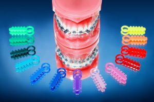 Enoch Braces